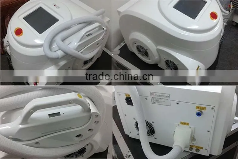 Spider veins and acne removal machine zeno with laser cost for home remedies
