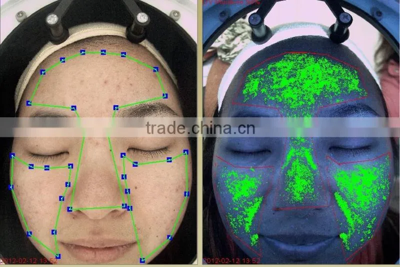 skin analyzer magnifier machine skin analysis system