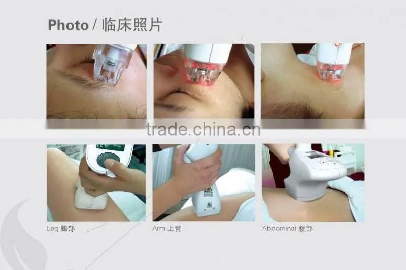 cellulite reduction vacuum slimming beauty machine