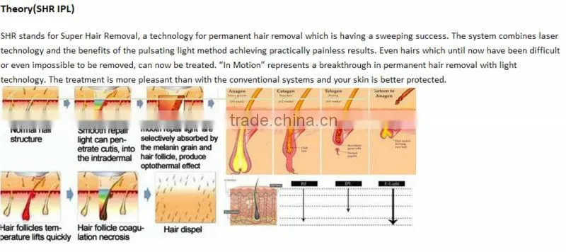shr in iplmachine hair remove for your beauty equipment