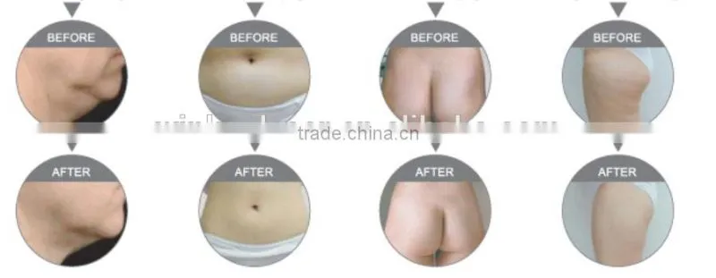 belly fat burning device / fat burning device