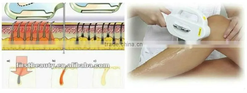 beauty equipment led machine for skin rejuvenation IPL Hair Removal and Beauty Machine for hair remover laser