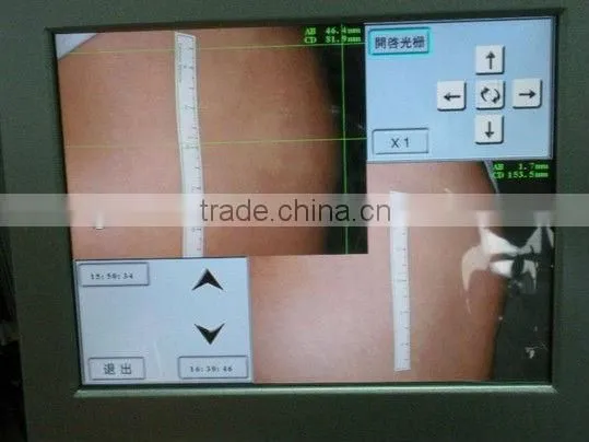 professional ultrasonic liposuction cavitation machine for sale