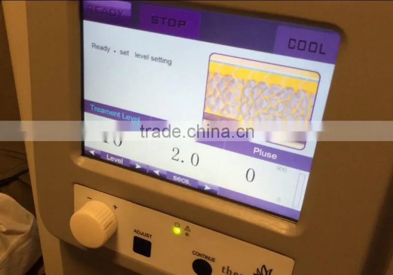 Facial resurfacing acne scar removal treatment fractional rf
