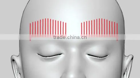CE Certificated HIFU portable machine/korea/body/face lift Belle-HIFUhifu high intensity focused ultrasound