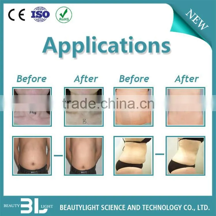 2016 Hot selling fat freezing machine cellulite reduction cavitation slimming machine