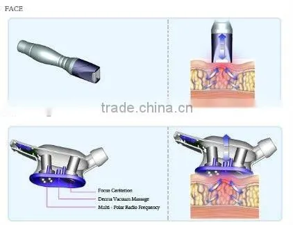 2012 32Khz Cavitation RF Weight Loss Machine CE