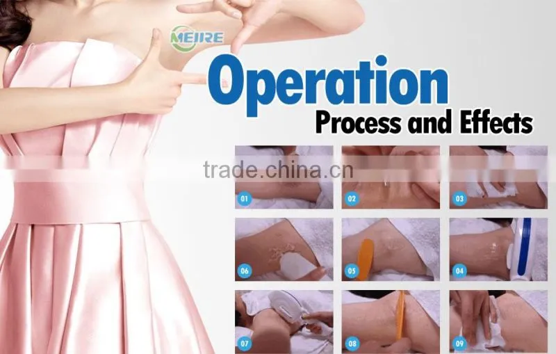 New design ipl shr opt laser permanent home medical device