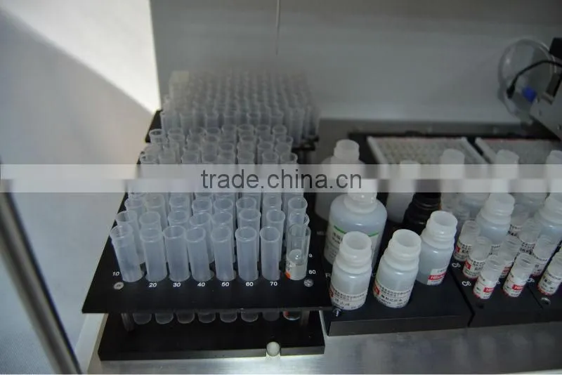 Fully automatc immune analyzer system , Elisa analyzer system (skype: fangfeimengxiang876)