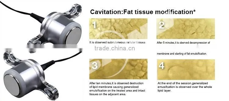 Factory Promotion Multifunction Slimming ultrasonic cavitation machine price