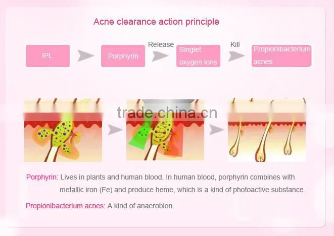 Laser skin machine hair removal device for permanent hair removal skin rejuvenation and acne clearance with 3 lamps
