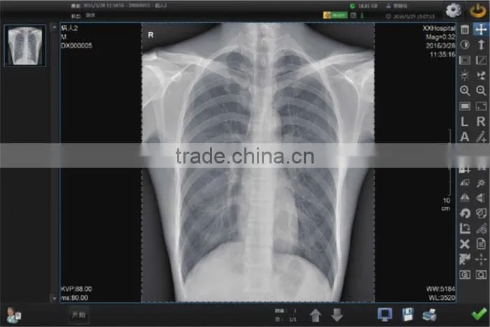 good selling cheapest price 14*17 inch FPD digital x ray flat panel detector