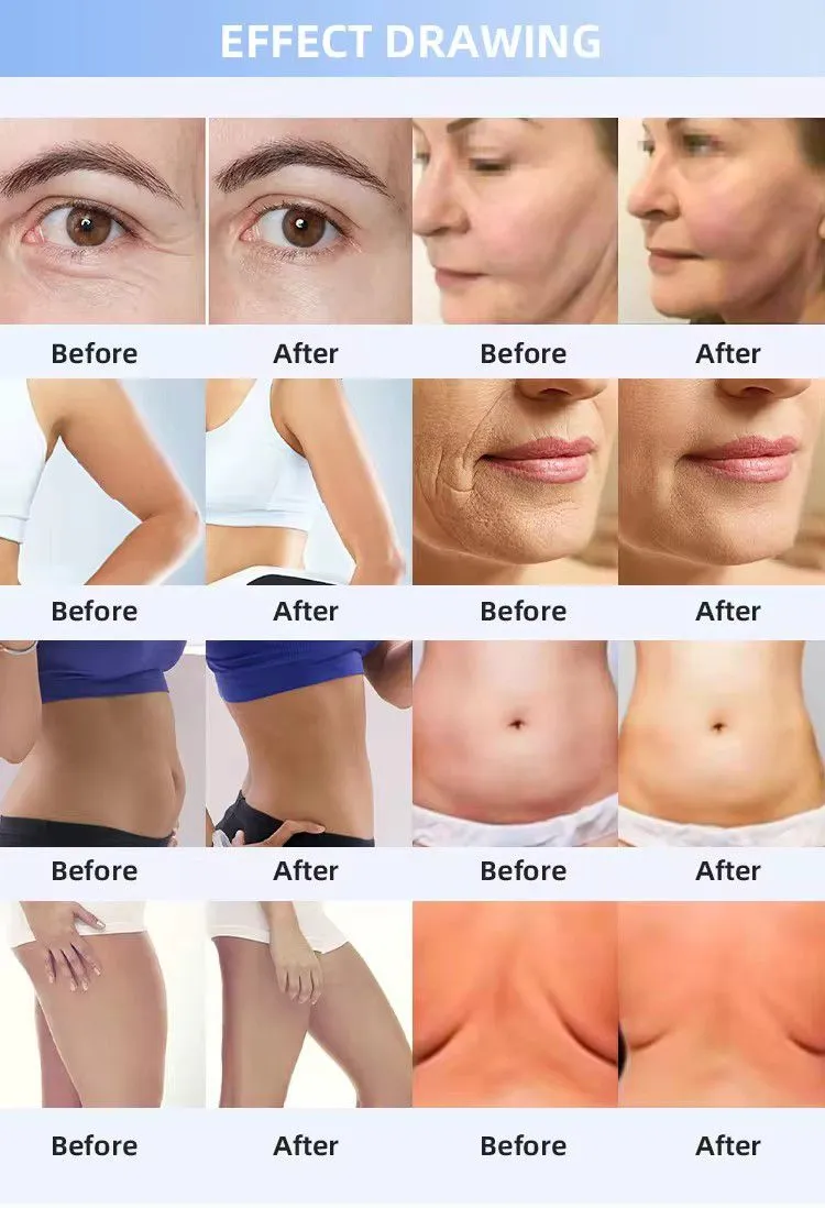 2024 Professional Desktop Multi-functional Anti Wrinkle Face Lifting Beauty Device