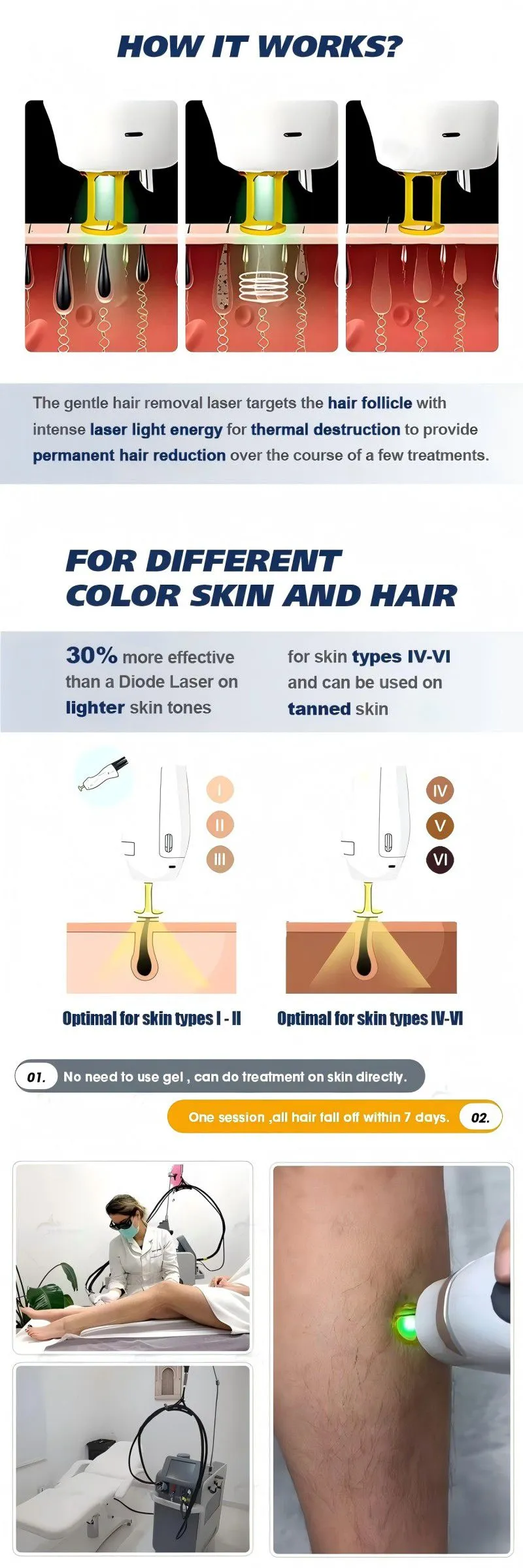 laserhairdepilation.jpg.webp