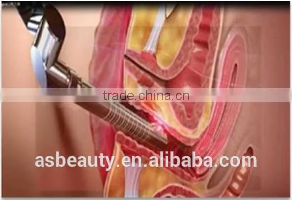 Private health,Beautify vagina CO2 fractional laser Vaginal tightening machine