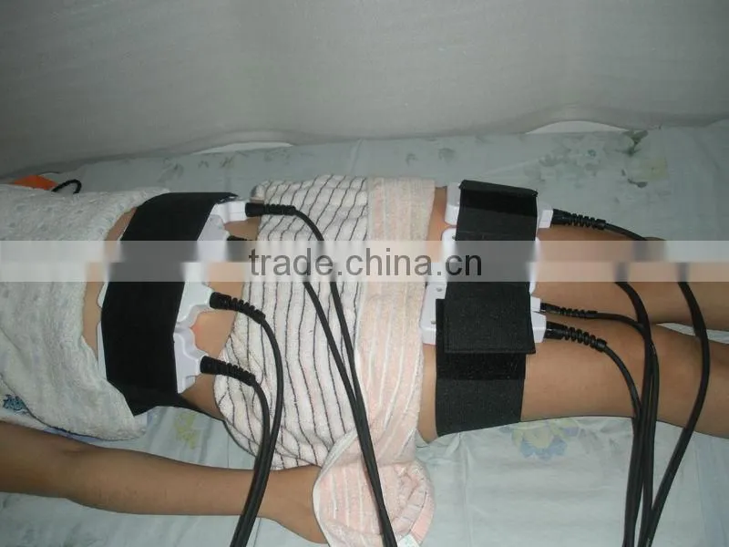 i-lipo laser fat reduction treatment
