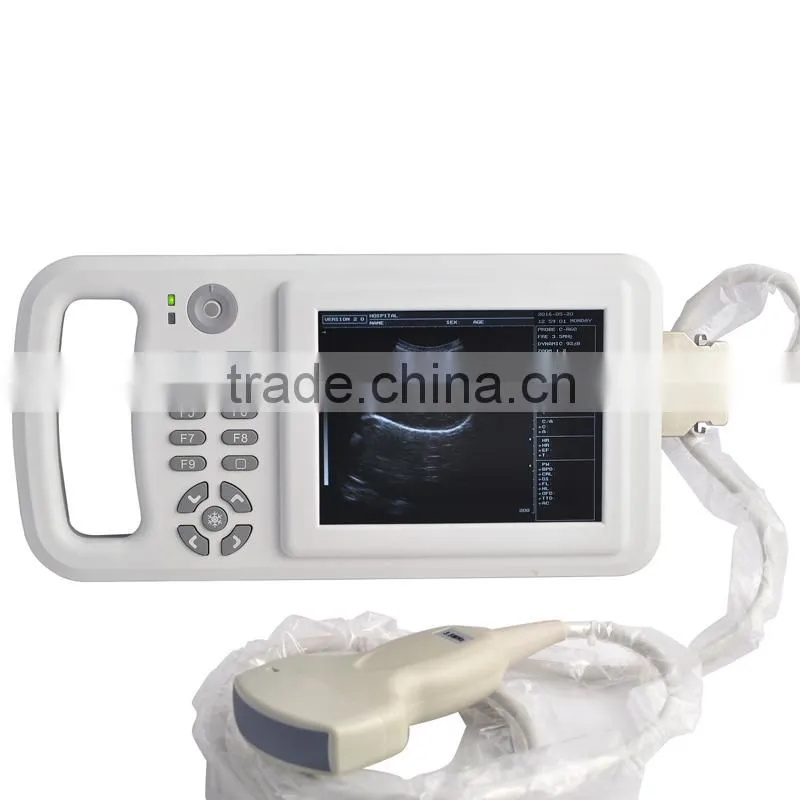 RUS-8000A Handheld veterinary B/W B ultrasound machine with high resolution and USB interface-Shelly