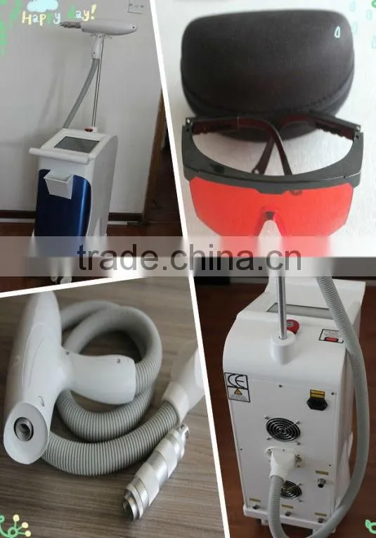 ND yag laser telangiectasia spider veins removal P003