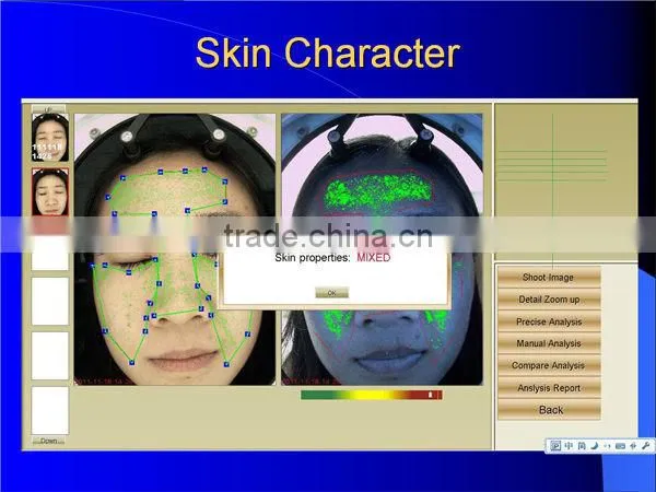 2016 Hot-sell Professional magic mirror skin analyzer,skin center/hospital use BD-P027
