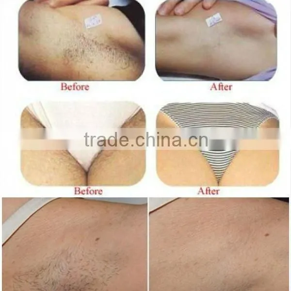 Korea facial hair epilator
