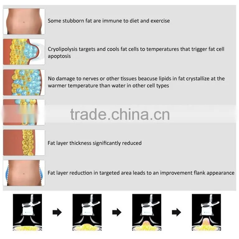 Safey cool tech shape fat freezing lipo machine cryolipolysis slimming machine in China