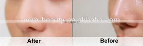 Best cleansing Product Facial cleansing brush For beauty care