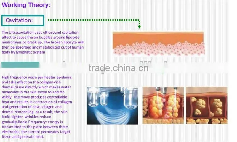 Anti Cellulite Vacuum Massage Body Slimming Machine F017