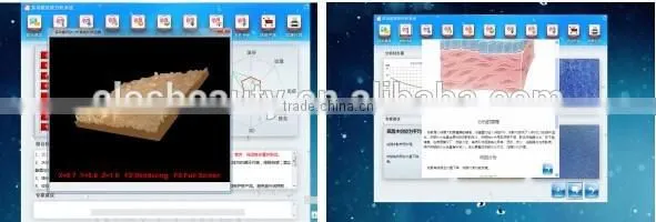 ELOS 3S 3 in 1 Skin Analyzer