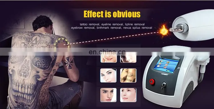 portable 2000mj laser tattoo only removal beauty machine nd yag laser