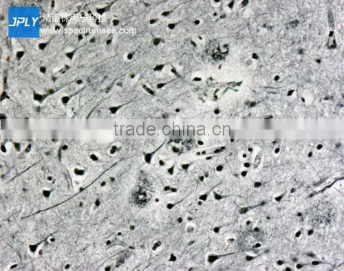 Factory Direct Sale 1.3MP Microscope USB3.0 Cmos camera