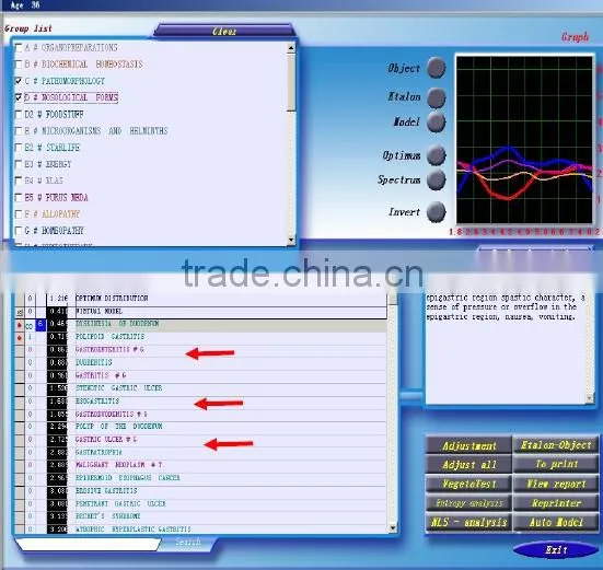 New Arrival 3D NLS Non-liner Analysis System Meridian Health Analyzer