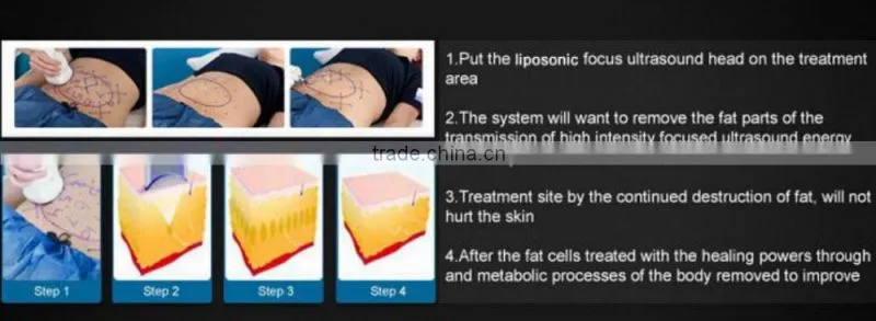LS08-laura USA popular fat killer liposonix hifu body slimming machine/hifu body shape