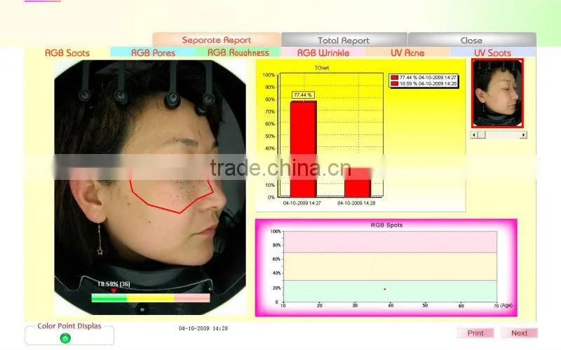 whole face testing skin analyzer magic mirror