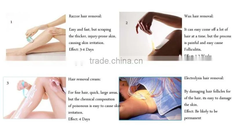 2016 professional Dialysis diode 808nm laser hair removal Machine for Sale