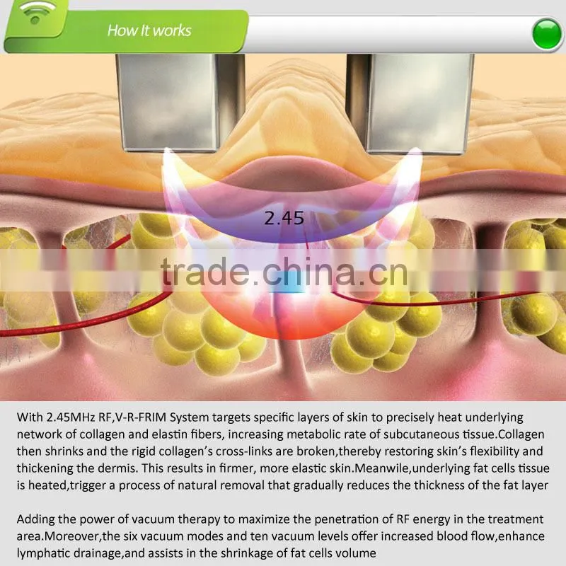 RF skin tightening beauty machine factory price with CE