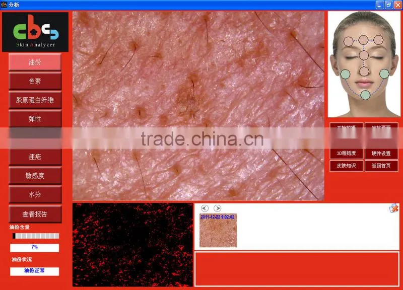 new products looking for distributor magic mirror skin and hair scanner 5.0 MP High Resolution CCD USB skin analyzer
