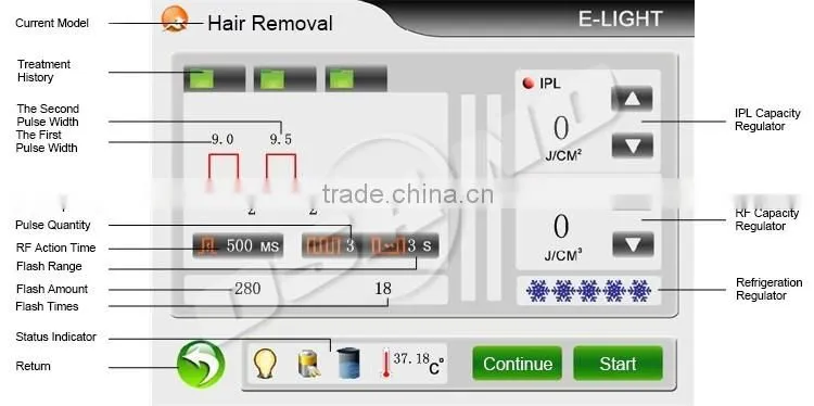 Diode Laser of types of laser hair removal machines