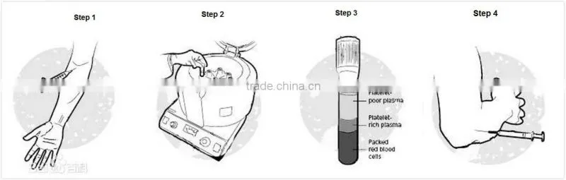 13*100mm steriled PRP tube used for skin treatment