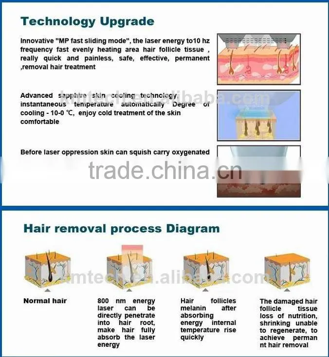 Christmas promotion !! professional tanning skin 10Bars laser diode 808nm for hair removal painless