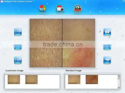 2014 New Designed Handheld skin analyze camera