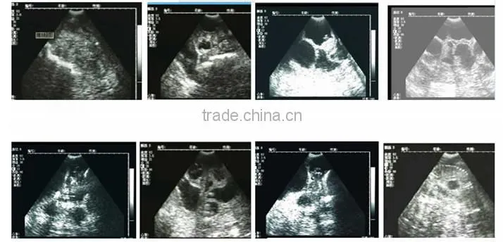 Veterinary ipad ultrasound scanner portable black and white visual pregancy test instrument