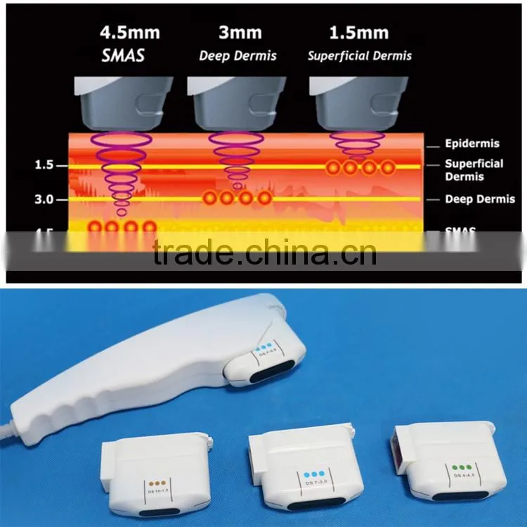 portable no-surgical treatment to tighten sagging skin beauty machine