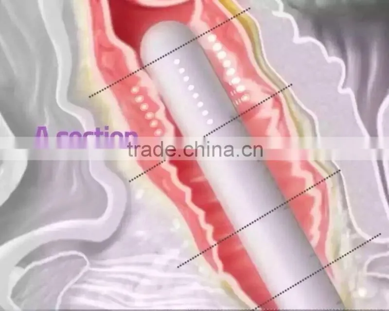 Hot selling health care vaginal tightening for femal