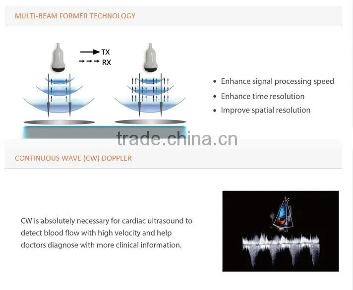 3D Trolley ultrasound scanner Color doppler ultrasound system (optional 4D)