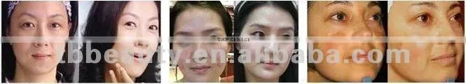 Home use PDT LED for facial rejuvenation machin
