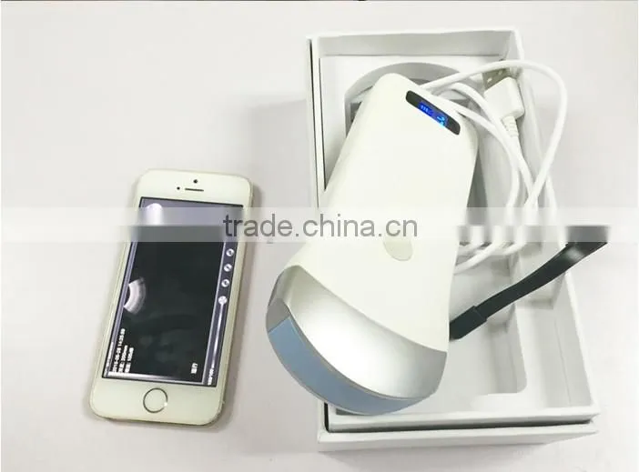 UltraSound Scanner, Convex Probe Ultrasound Scanner, WiFi, 3.5MHz / R40 / 64 Elements, SIFULTRAS-5.1