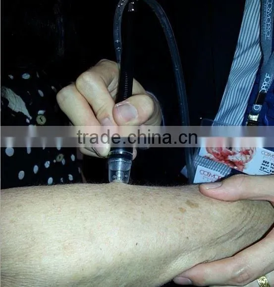 2016 spa9.0 microdermabrasion machine parts