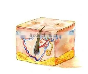 Patent contact cooling tips ICE SHR technology hair removal aesthetic equipment ICE 1