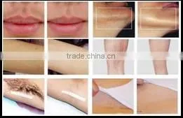 factory OEM 808 diode laser hair removal machine/depilation/professional hair removal 808