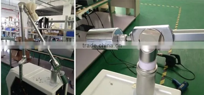 Q-switch Laser ND YAG for Tattoo Removal/laser yag